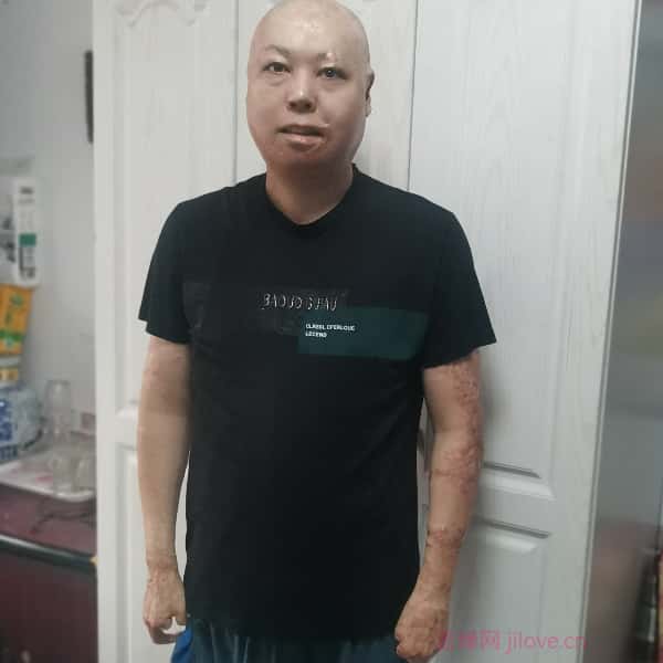 河北残疾人帅哥真诚相亲找对象，黔东南征婚网